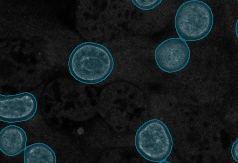 Dynamic Content Image